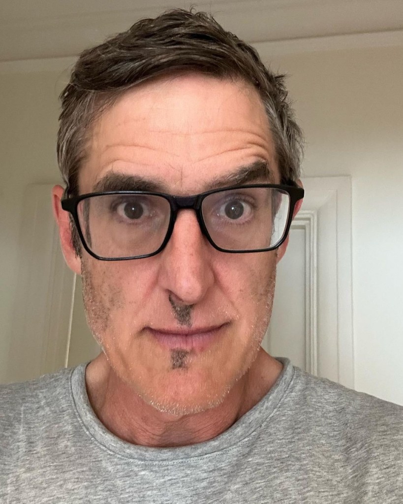 Louis Theroux alopecia update