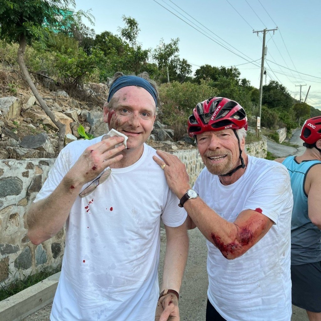Richard Branson's bloody injuries revealed after horror bike accident Instagram